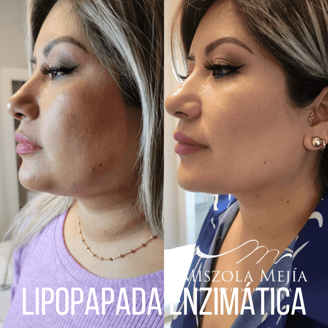 Facial Misz