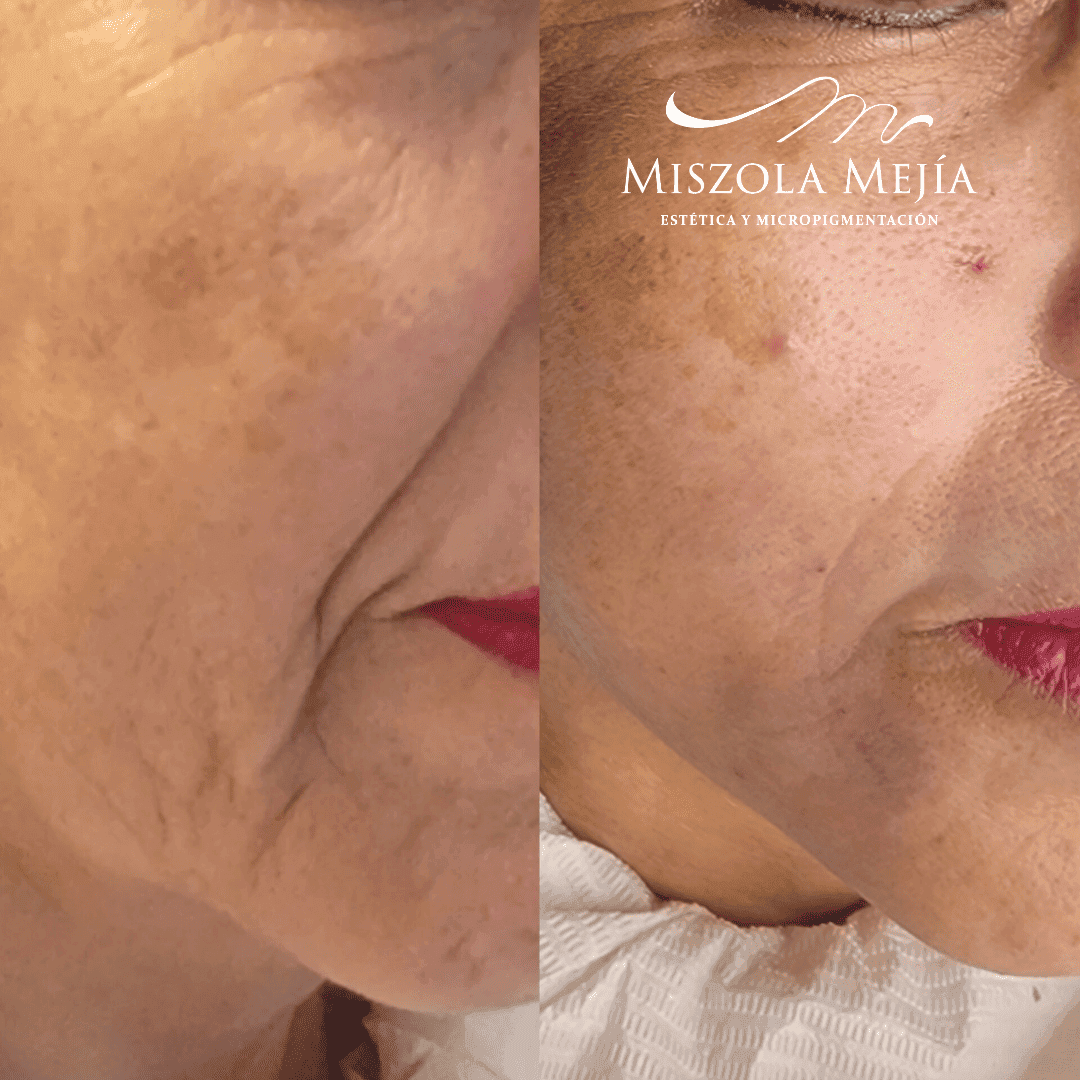 Facial Misz