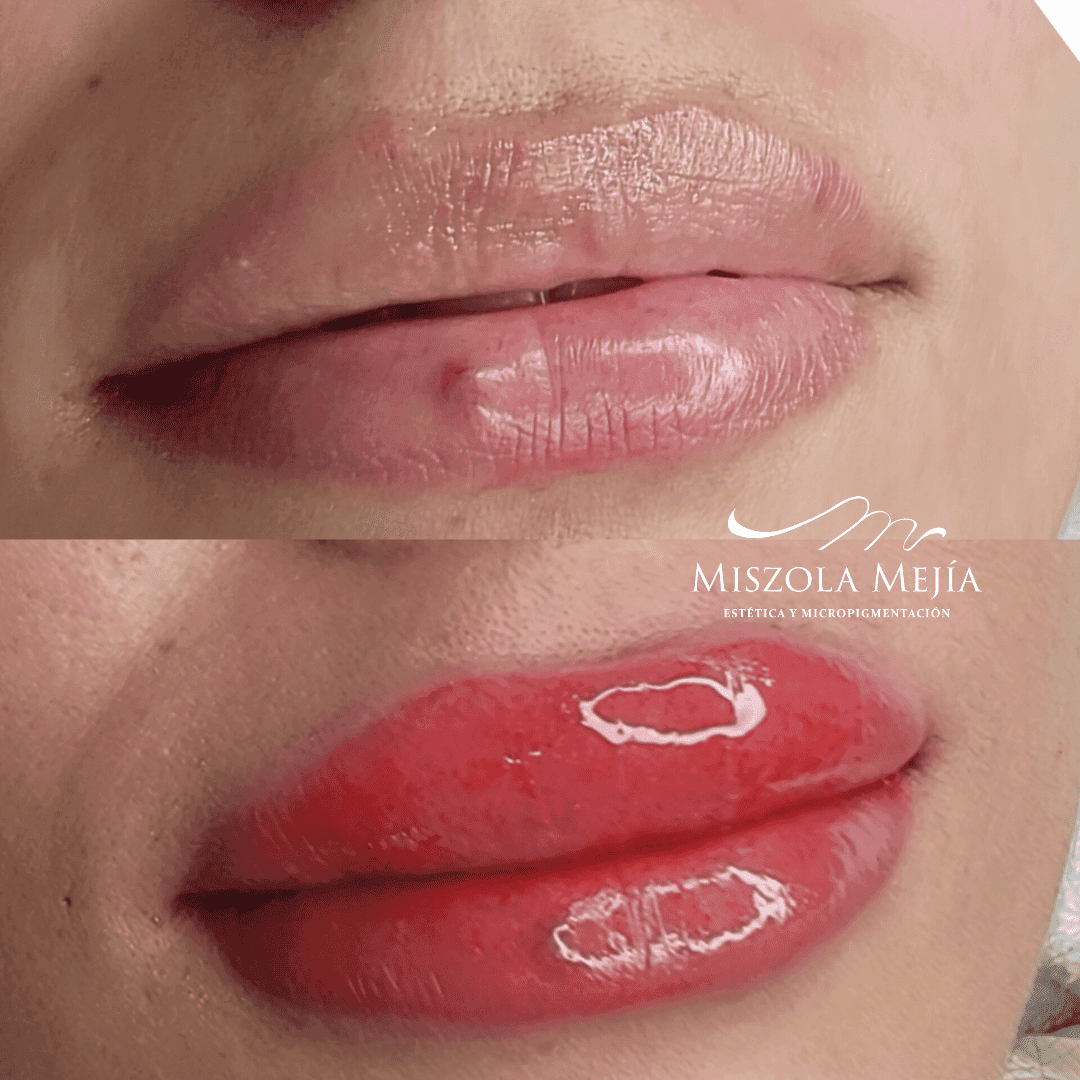 Labial Misz