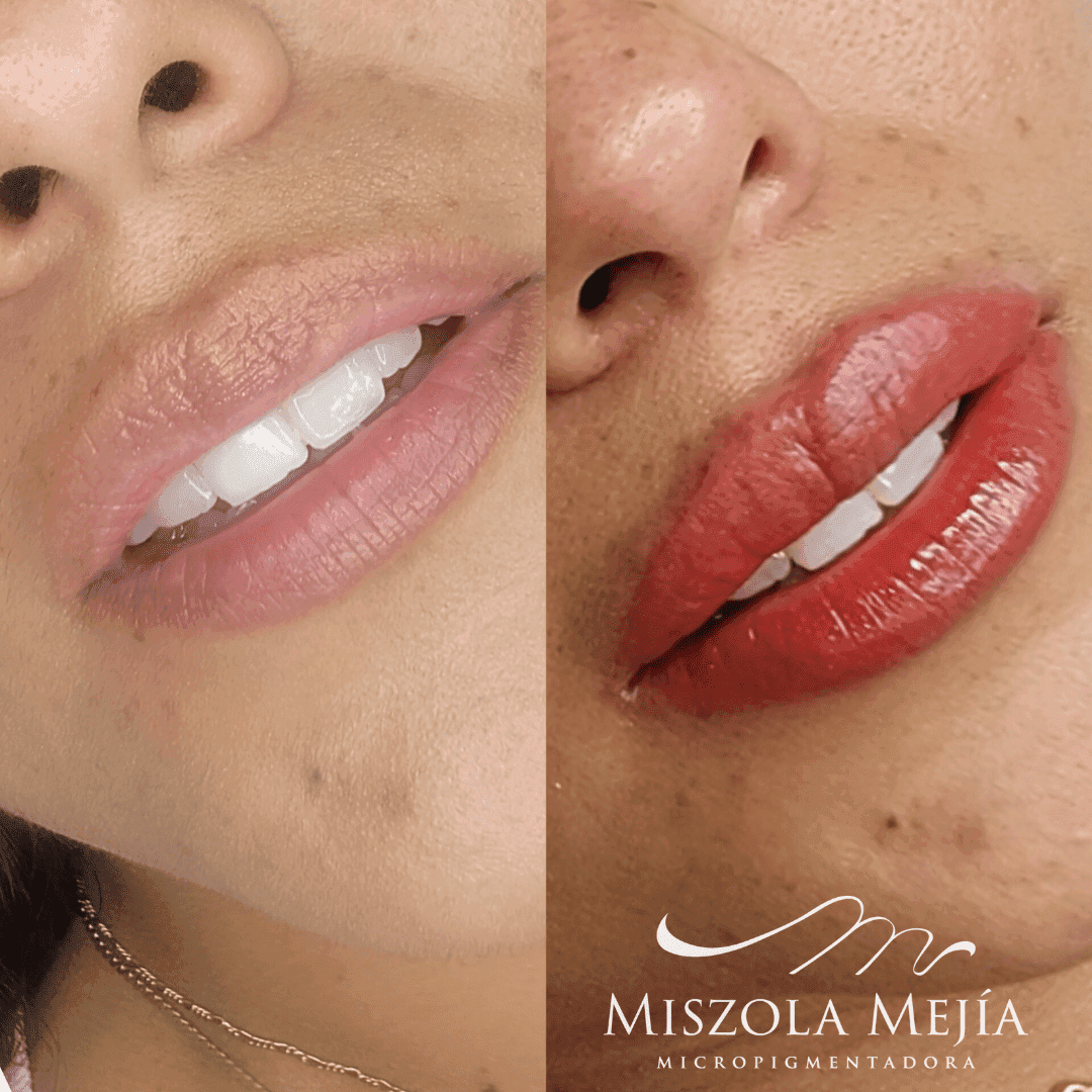 Resultado Labios Acuarella: color natural y durable — clienta real Misz Estética Lima