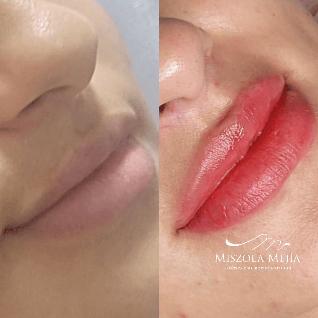 Labial Misz